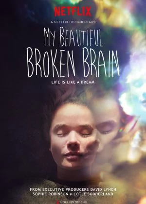 My Beautiful Broken Brain poster